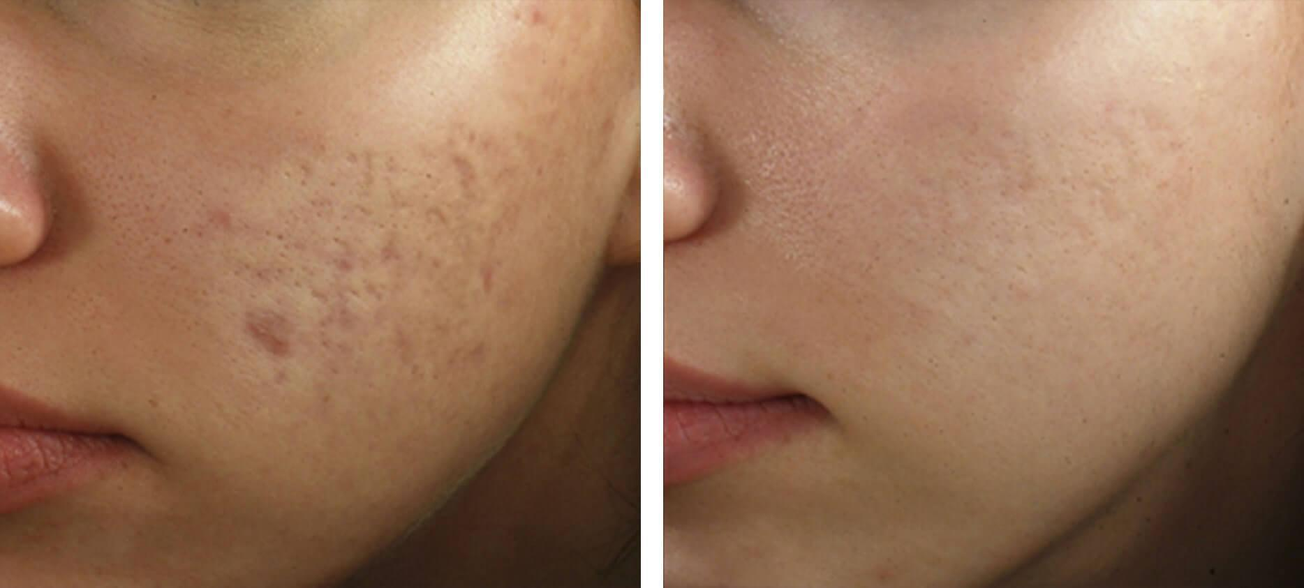 Patient transformation result